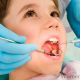 Методы безболезненного лечения зубов у детей